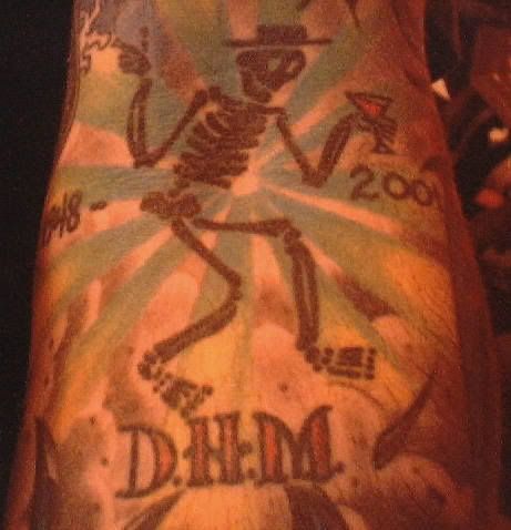 arm 1